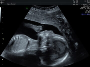 Introduction to OB GYN Course - Sonosession