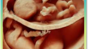 OB GYN Ultrasound Hands-On Workshop April 25, 2026, Asheville, NC