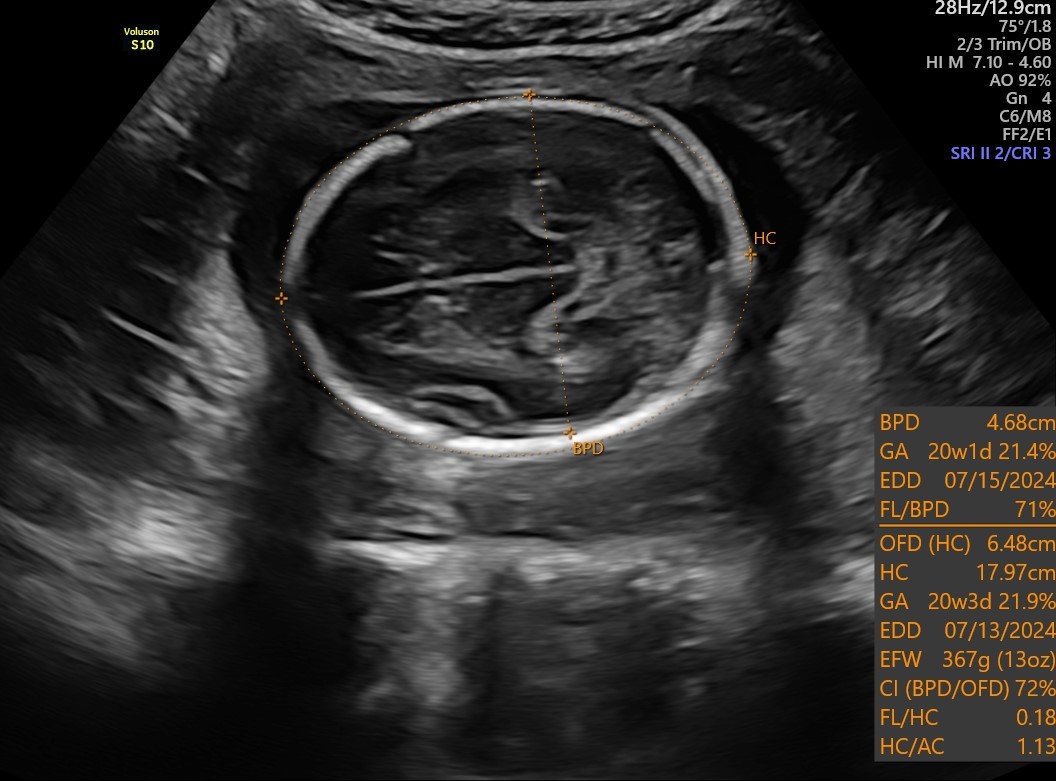 Routine Growth Anatomy Scan Sonosession routine-growth-anatomy-scan-sonosession