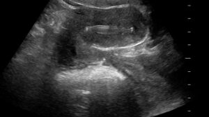 OB GYN Hands-On Ultrasound Workshop March 6, 2027, Monterey, CA