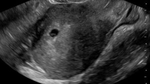 OB GYN Hands-On Ultrasound Workshop May 2, 2026, Monterey, CA