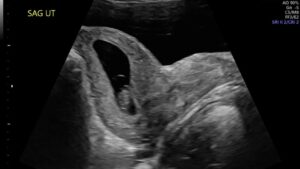 OB GYN Hands-On Ultrasound Workshop February 13, 2027, Monterey, CA