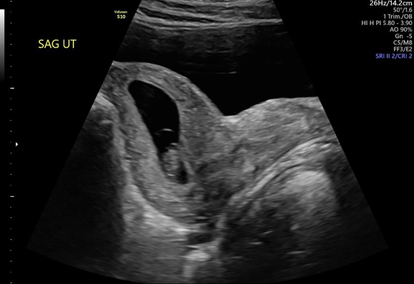 OB GYN Hands-On Ultrasound Workshop February 13, 2027, Monterey, CA