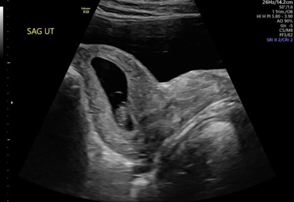 OB GYN Hands-On Ultrasound Workshop May 2, 2026, Monterey, CA - Sonosession