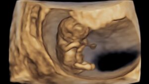 In-Person OB-GYN Ultrasound Workshop: November 7, 2026, Asheville, NC