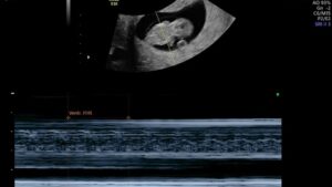 OB GYN Ultrasound Hands-On Workshop August 8, 2026, Asheville, NC
