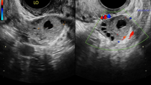 OB GYN Hands-On Ultrasound Workshop July 11, 2026, Monterey, CA