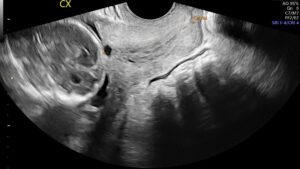 OB GYN Hands-On Ultrasound Workshop January 16, 2027, Monterey, CA