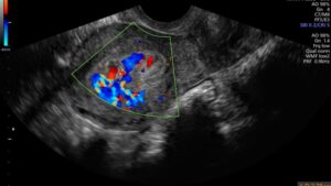 OB GYN Ultrasound Hands-On Workshop September 12, 2026, Asheville, NC