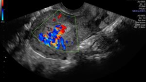 OB GYN Hands-On Ultrasound Workshop November 7, 2026, Monterey, CA